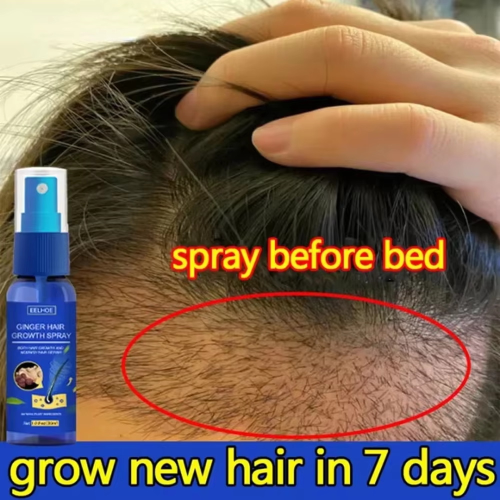 Hair Care Lotion - بخاخ الزنجبيل السريع لنمو الشعر، مصل