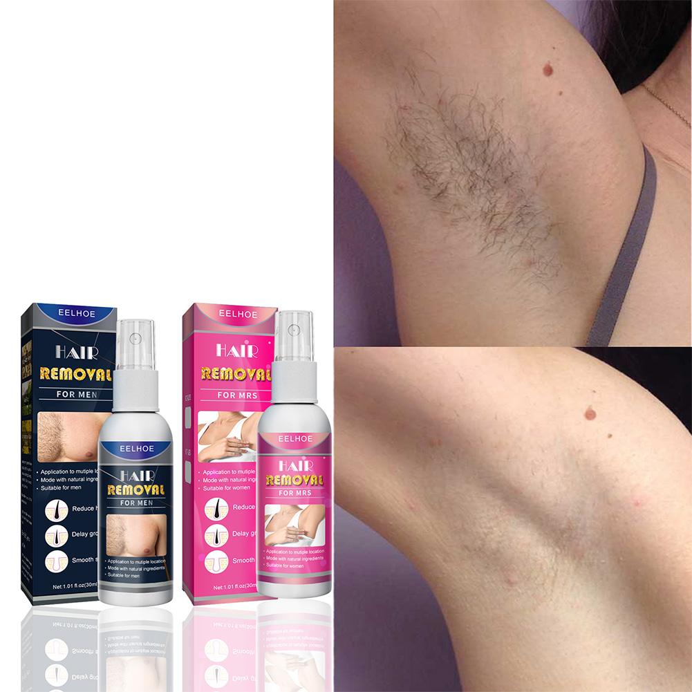 1/2 قطعة مزيل الشعر الدائم غير - مراجعة Hair Care Lotion وسعره